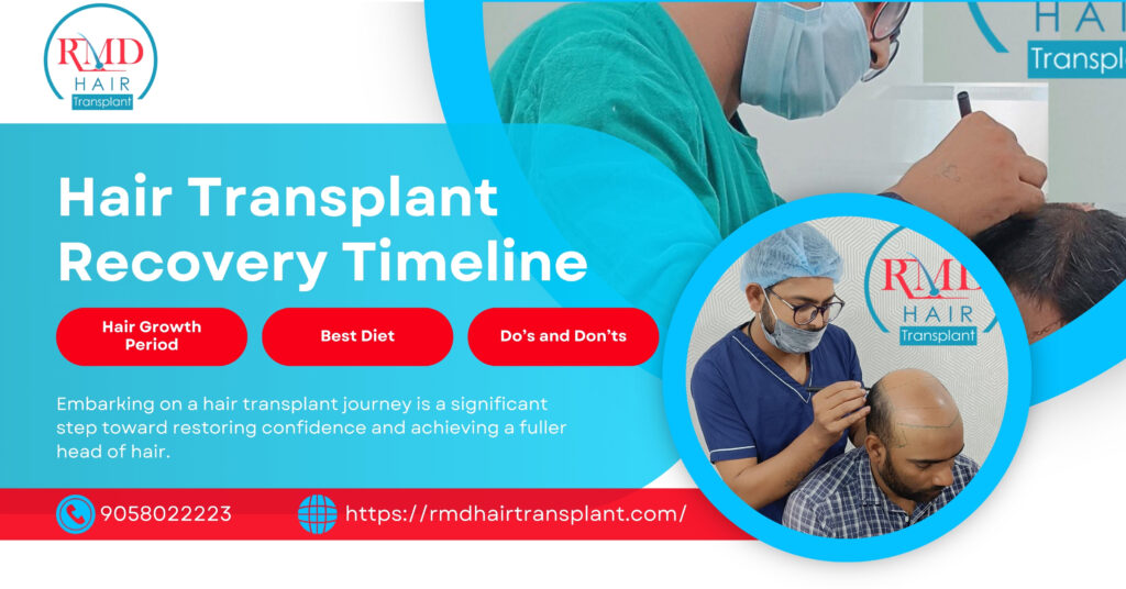 Read more about the article Hair Transplant Recovery Timeline: A Friendly Guide to Healing and Growth