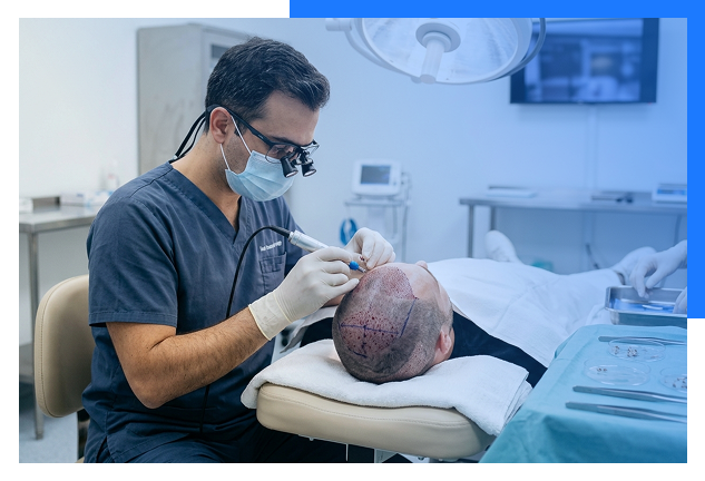 FUE Hair Transplant Bhopal