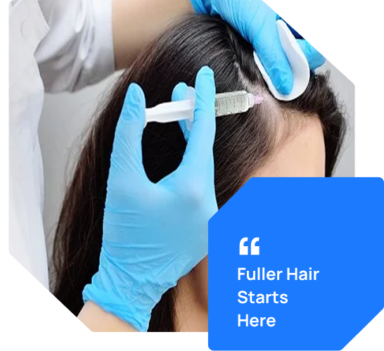 PRP Therapy For Hair Bhopal 2
