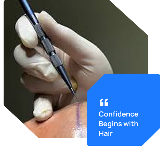 Sapphire Hair Transplant Bhopal
