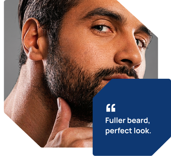 Why Choose RMD For Beard Hair Transplant In Indore